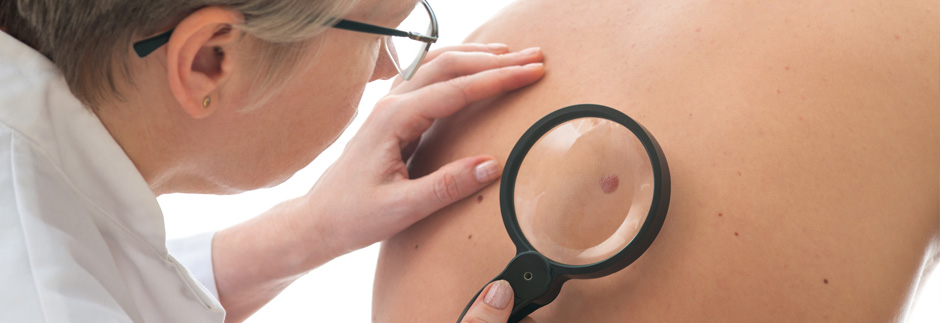 Skin Cancer Checks